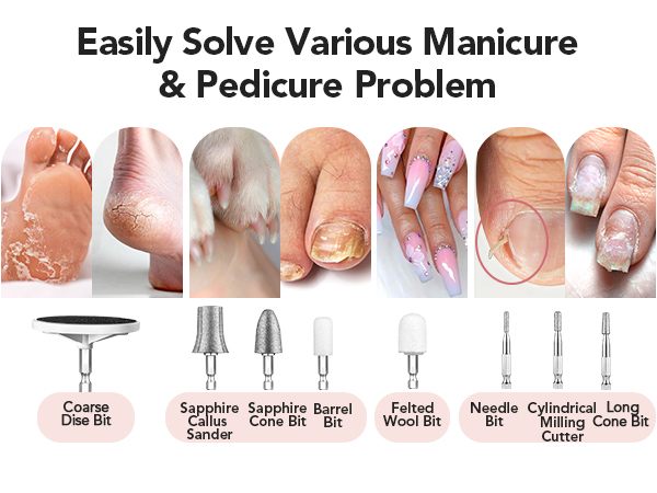 electric toenail clippers