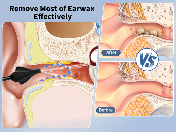 ear washer