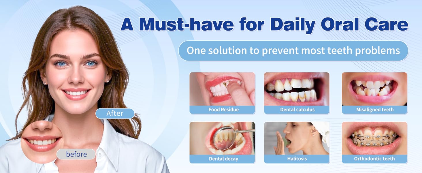 Tovendor electric flosser with 5 Multifunction Nozzles will help you keep oral and teeth health