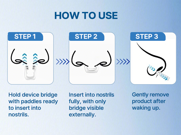 Anti Snoring Devices