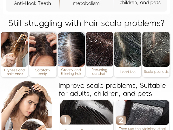 dandruff comb