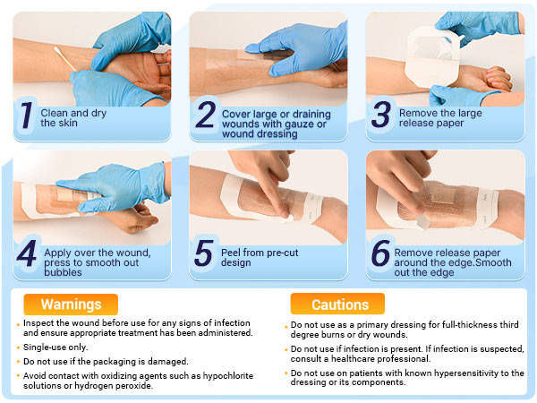 schneider is dedicated to delivering professional wound care solutions