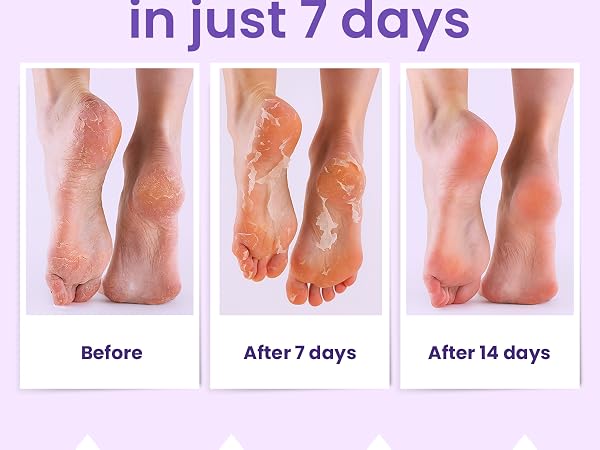 best foot peeling masks exfoliating foot mask exfoliating foot peel exfoliating foot peel mask exfol