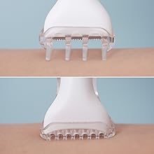 Skin Guard Attachement