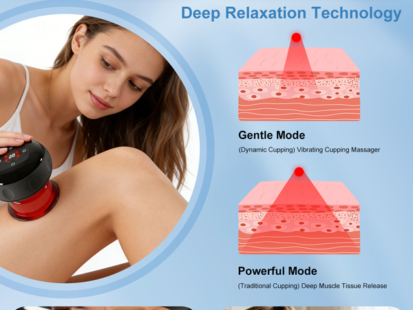 cupping therapy set