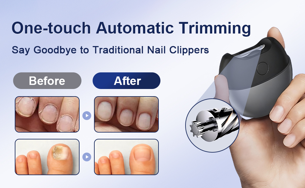 electric nail clippers for toenails