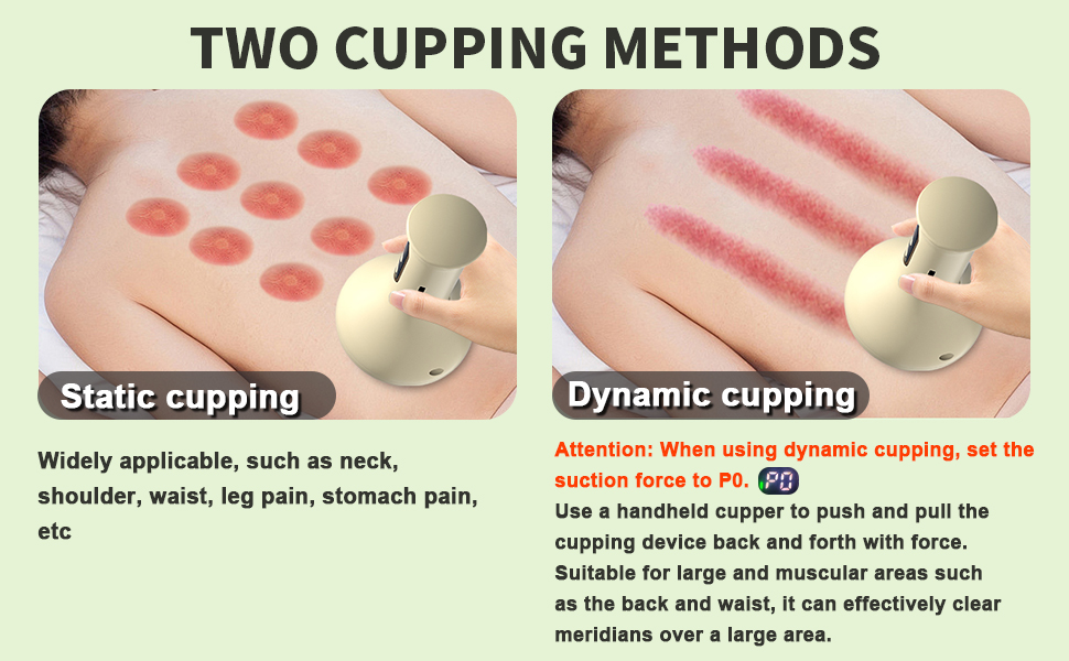 Cupping Device Handheld Electric Cupping Massager