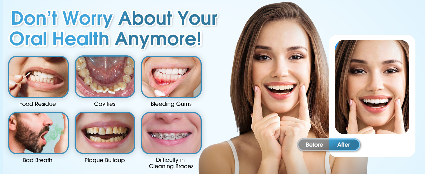 dental water flosser