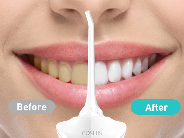 water dental flosser pick teeth cordlss portable Hilo dental con agua, recoge los dientes
