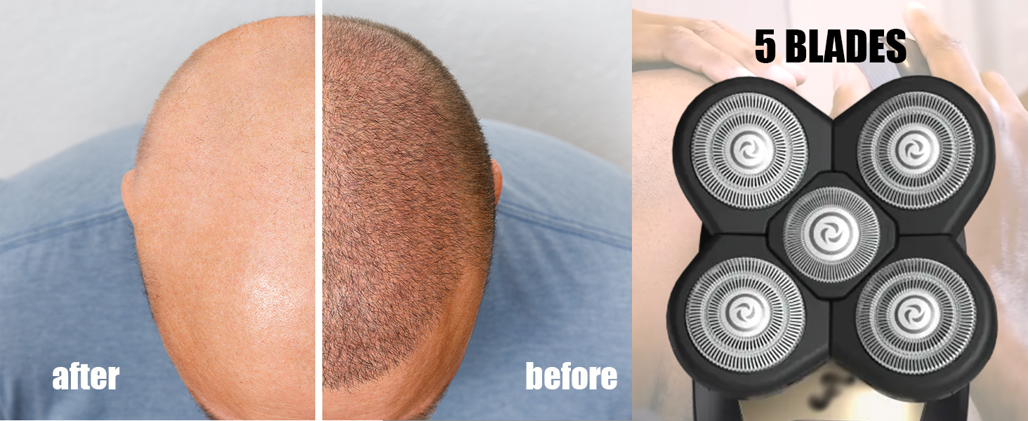 Bald Men shaver head