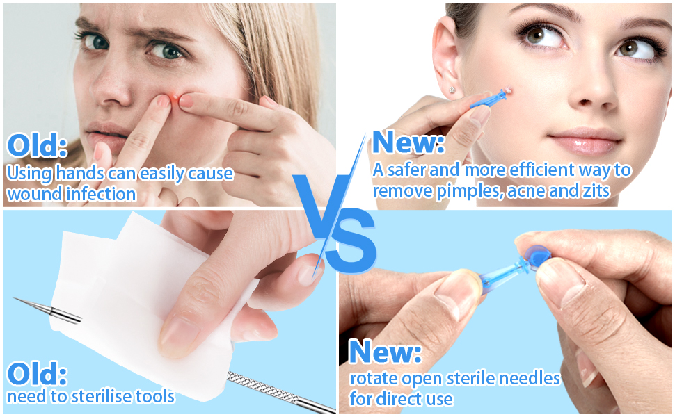 acne needle