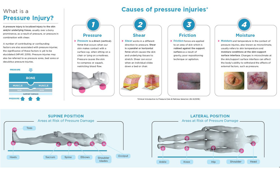 What is a pressure injury