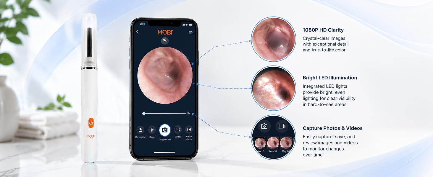 MOBI Smart Ear Camera with HD smartphone view and feature callouts for imaging and LED lighting