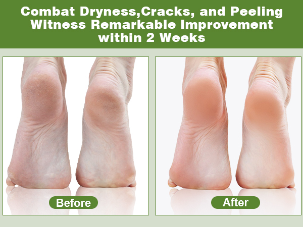 WITNESS REMARKABLE IMPROVEMENT