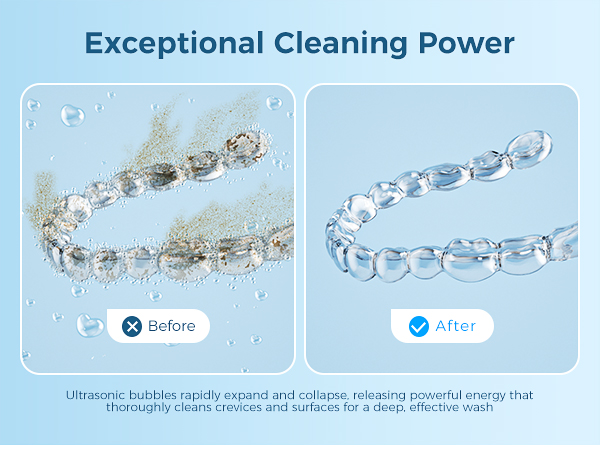 Ultrasonic Retainer Cleaner ultrasonic cleaner ultrasonic cleaner machine ultrasonic retainer