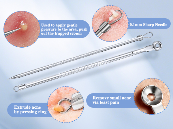 black head remover