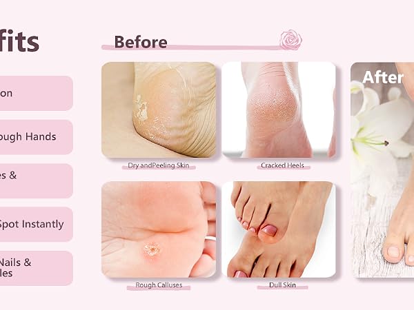 Moisturizer Sock for Dry Cracked Feet Heel