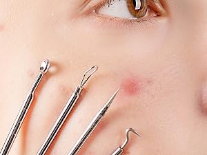 Acne Pimple Extractor Tool