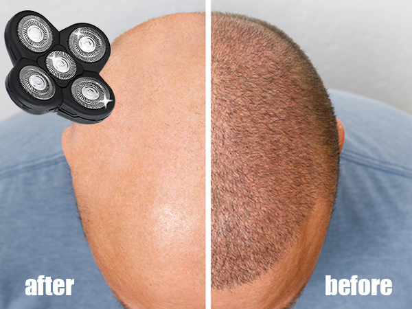  Bald Men shaver head