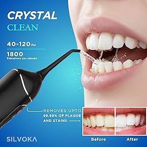 water flosser for teeth