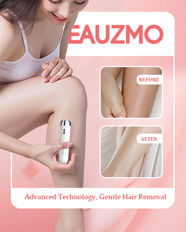 Epilator