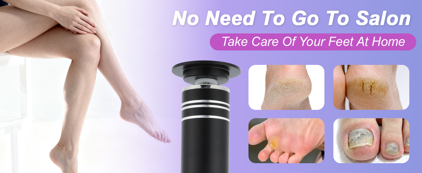 Electric Foot Callus Remover