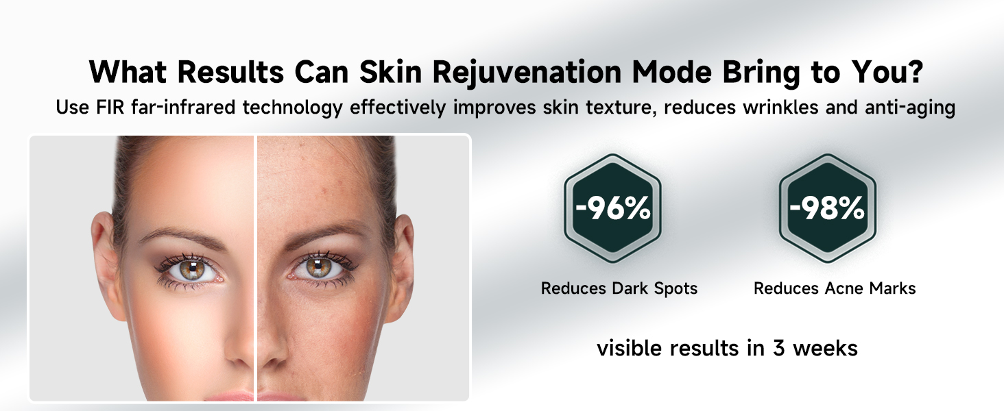 ipl laser hair removal