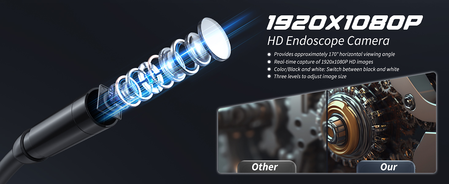 endoscope