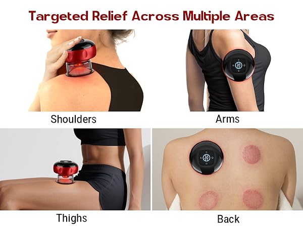 cupping