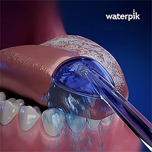 Using the Waterpik Tongue Cleaner Tip TC-100E