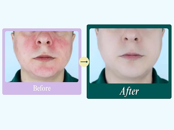 before and after 2
