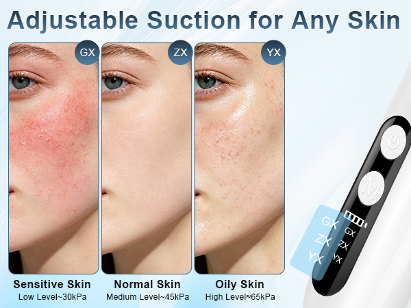 pore vacuum for face