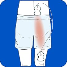 Omron TENS Pads