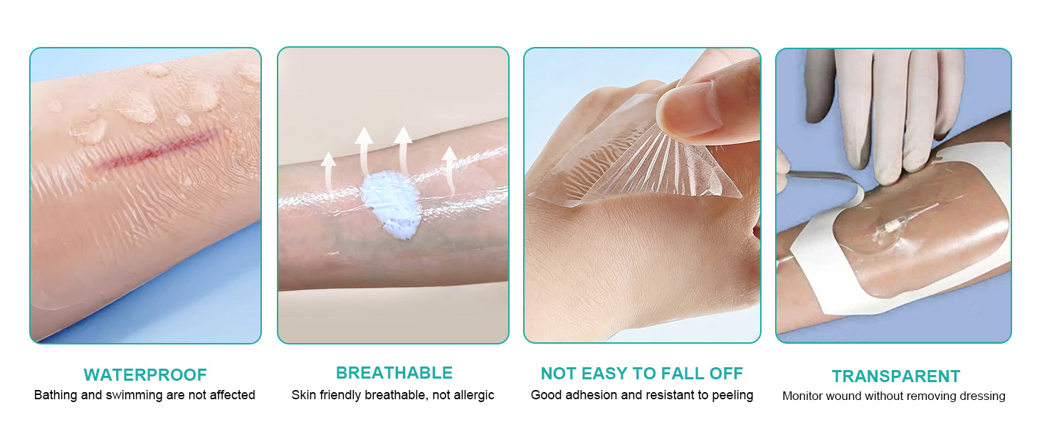 Transparent Film Dressing