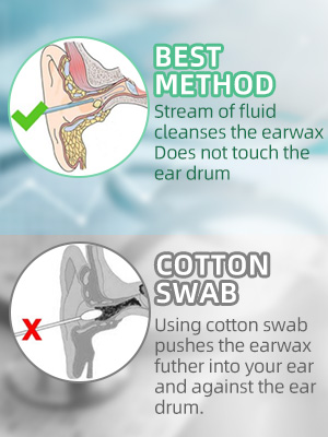 earwax removal kit