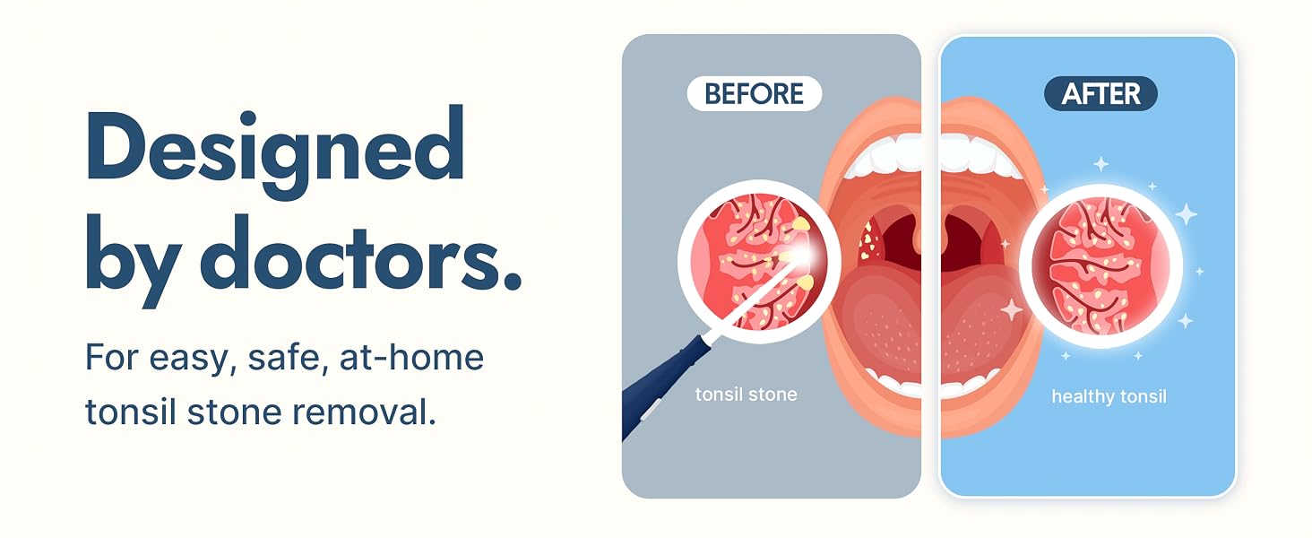 easy tonsil stone remover