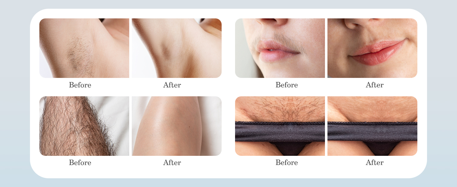 Bikini Trimmer for Women