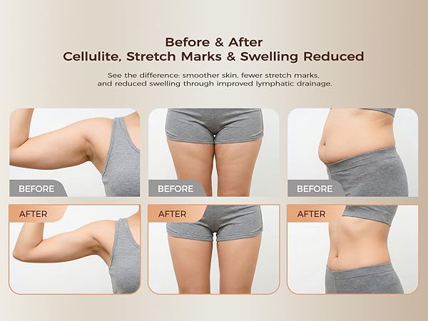 lymphatic drainage tool