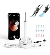 Bebrid pro Ear Canal Wax Removal Tool Camera Tweezers - Note5 Pro Wireless Cleaner Otoscope with ...