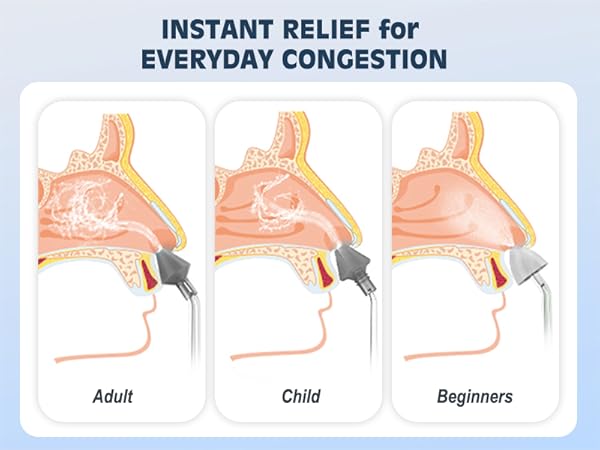 electric nasal irrigation system