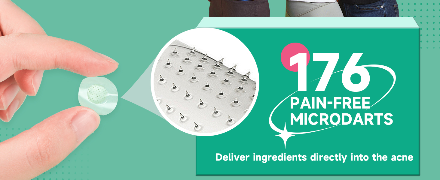176 PAIN-FREE MICRODARTS