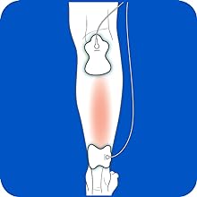 Omron TENS Pads