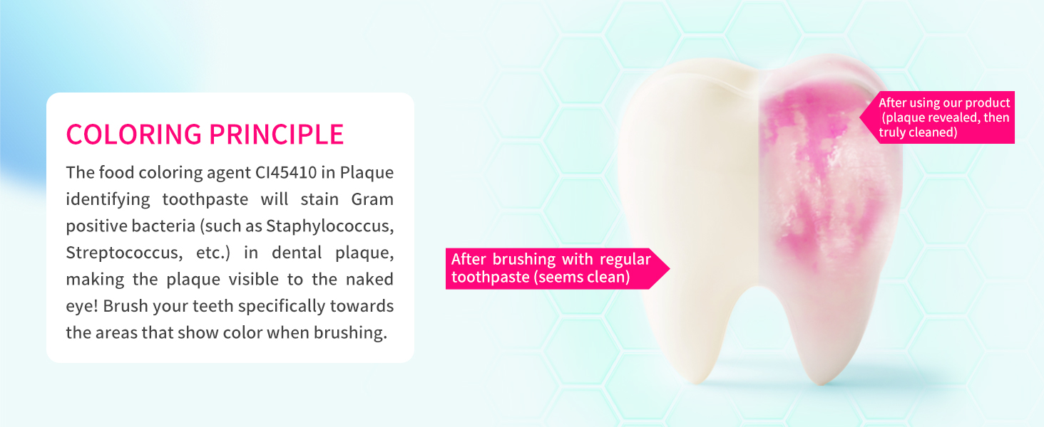 plaque remover