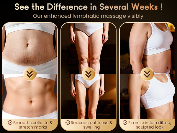 Lymphatic Drainage Massager &amp;amp; Anti Cellulite Massage Tool