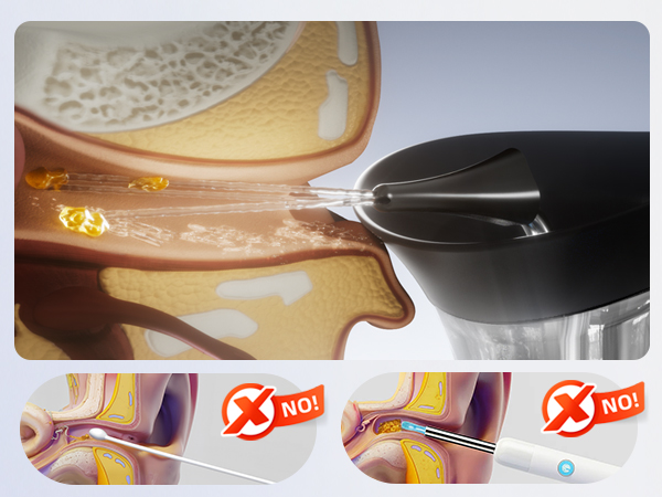 electric ear wax removal kit earwax remover ear cleaner cleaning tool irrigation flushing washer