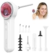 ScopeAround Otoscope, 720PHD Ear Scope Set, Digital Otoscope w/1.85in IPS Screen, Ear Wax Removal...