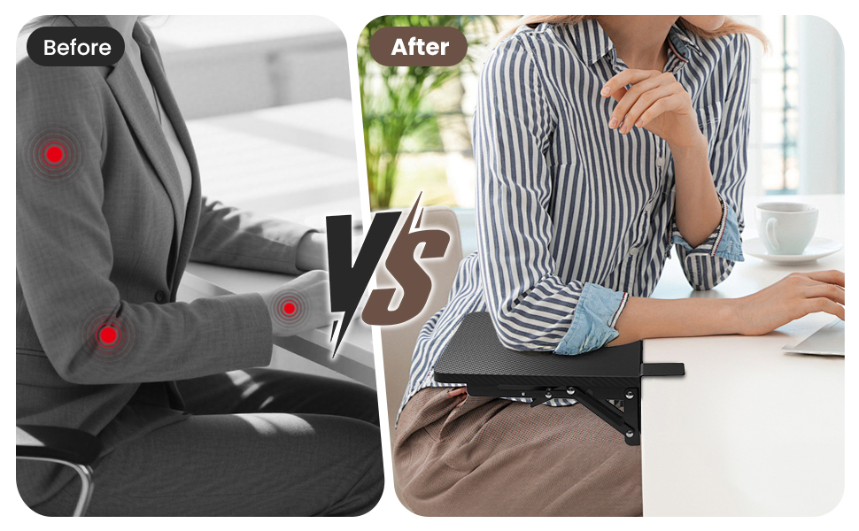 Elbow Arm Rest tray