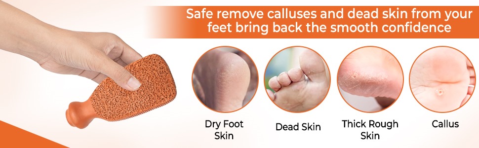 Pumice Stone for Feet