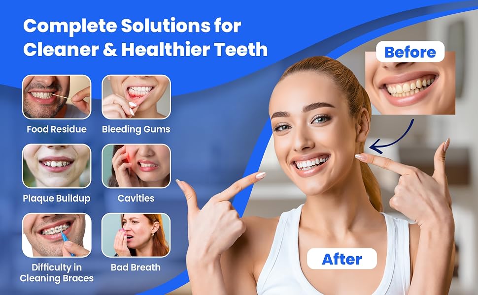 Smilix water flosser before and after results for cleaner, healthier teeth