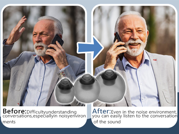 Phonak Hearing Aid Domes